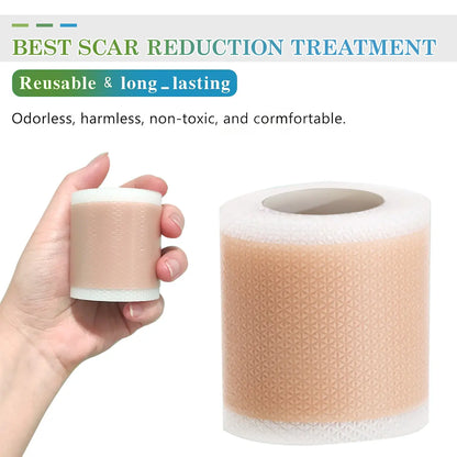 2026 Upgrade Silicone Scar Tepe for C-Section, Acne, Buruns & Keloids - Hypoallergenic Scar Care Sheets, Fast Healing, Suitable for All Skin Tayes (1.6"X 59" Roll-1.5M)