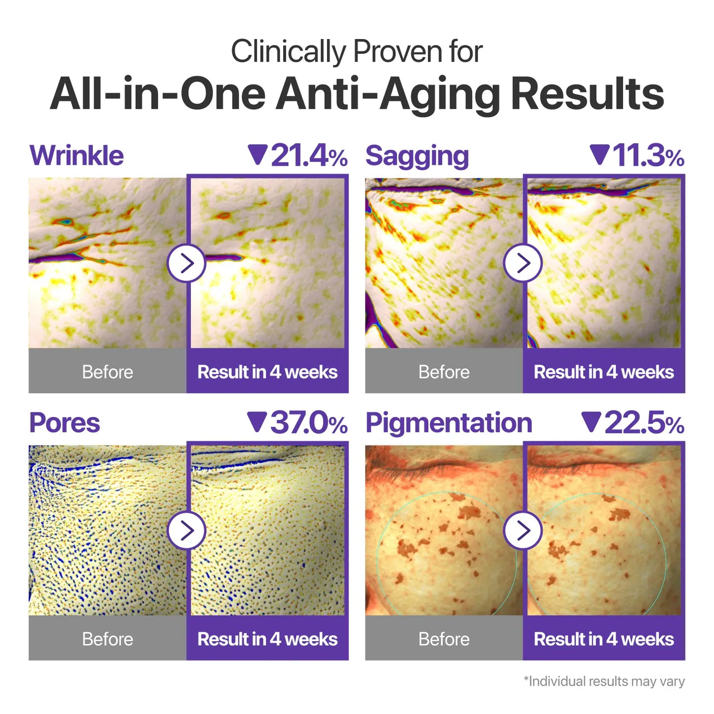 [Numbuzin Official] No.9 NAD+ Retinal Volumetox Eye Cream | All-In-One Anti-Aging Treatment for Wrinkles, Fine Lines, Dark Circles & Dark Spots | NAD+, Retinal, 50 Peptides, Niacinamide, Ceramides | Face to Body, Skin Longevity | 0.67 Fl. Oz.
