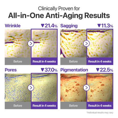 [Numbuzin Official] No.9 NAD+ Retinal Volumetox Eye Cream | All-In-One Anti-Aging Treatment for Wrinkles, Fine Lines, Dark Circles & Dark Spots | NAD+, Retinal, 50 Peptides, Niacinamide, Ceramides | Face to Body, Skin Longevity | 0.67 Fl. Oz.